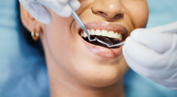 Best Emergency Wisdom Teeth Removal in Massillon, OH